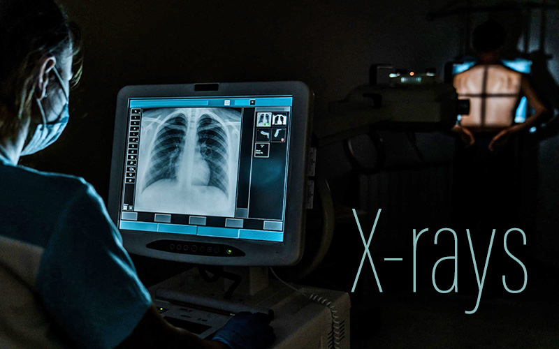 radiología-combinada-de-redes